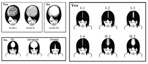 Assess Hair loss in female