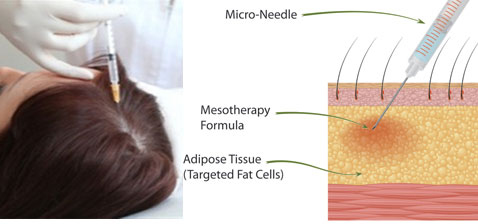 Why do you need to take folic acid with methotrexate when pregnant