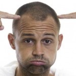 Ways to treat Male Pattern Baldness or hair loss